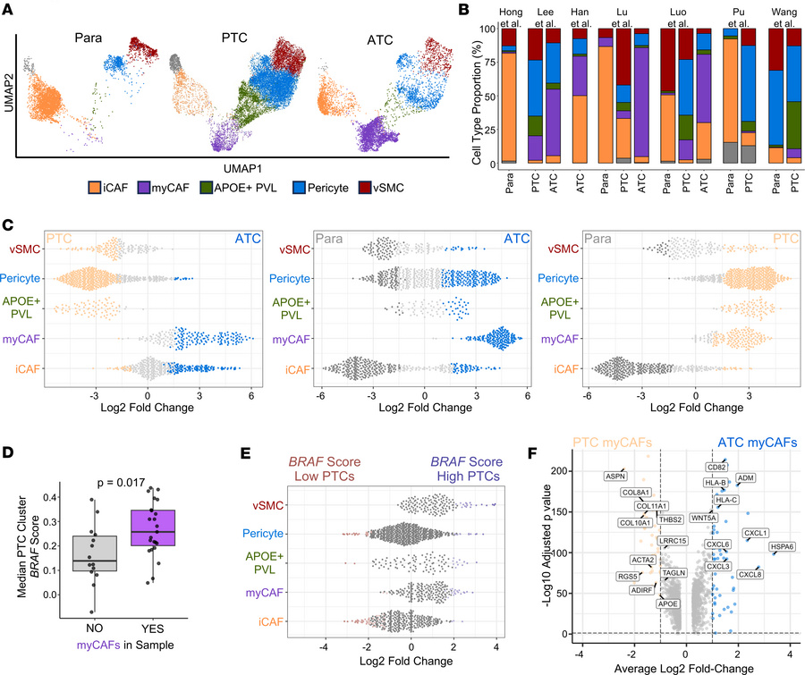 myCAFs are enriched in anaplastic and BRAF-like papillary thyroid cancer...