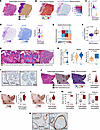 Spatial localization of perivascular populations in thyroid cancer.