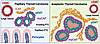 Overview of stromal architecture in thyroid cancer progression.