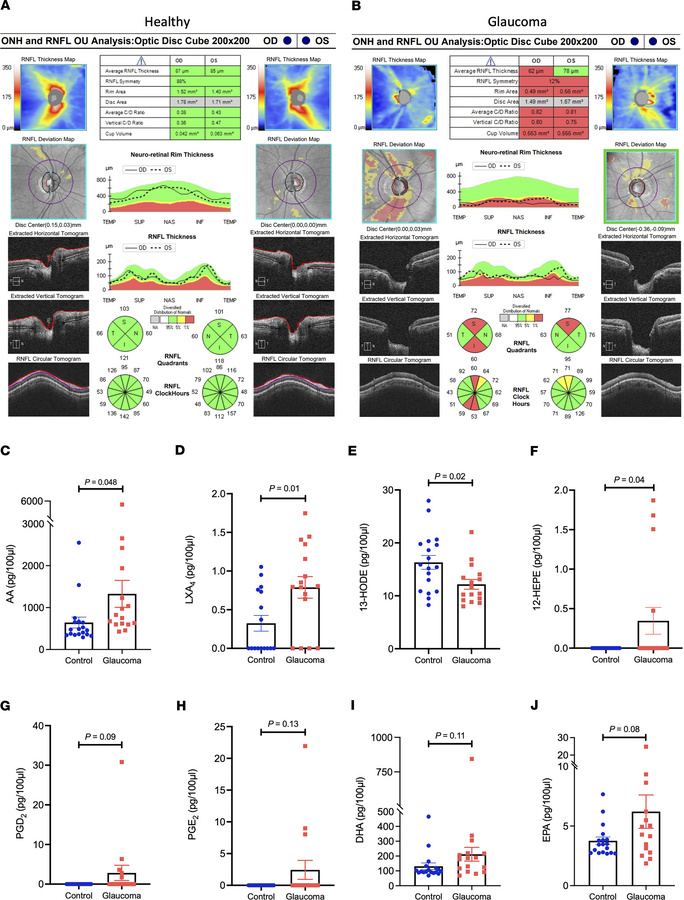 The AA/lipoxin pathway is specifically elevated in glaucomatous aqueous ...