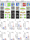 The AA/lipoxin pathway is specifically elevated in glaucomatous aqueous hum