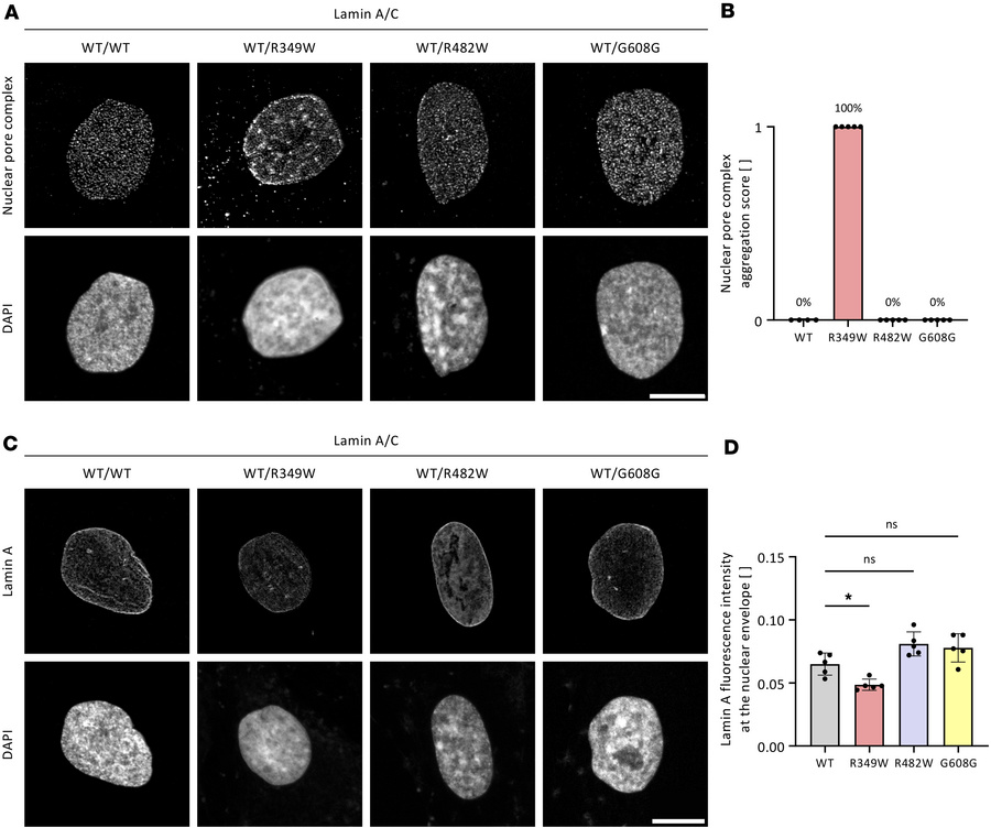 Lamin A/C Arg349Trp localizes to the nuclear envelope and associates wit...