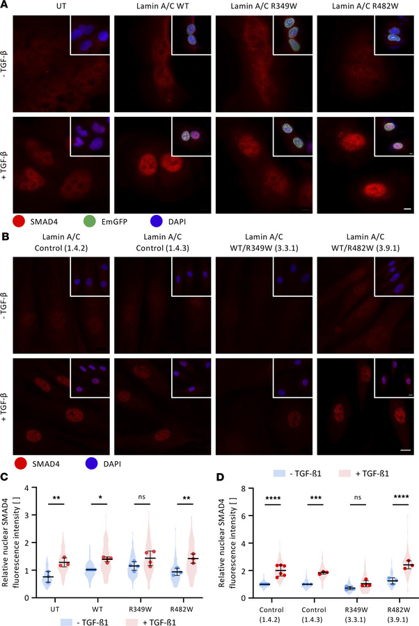 In podocytes and patient-derived fibroblasts, lamin A/C Arg349Trp impede...