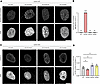 Lamin A/C Arg349Trp localizes to the nuclear envelope and associates with n