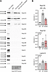 The Arg349Trp substitution in lamin A/C impairs the structural interaction