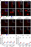 In podocytes and patient-derived fibroblasts, lamin A/C Arg349Trp impedes T