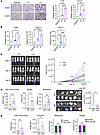 Acquired anoikis resistance leads to increased in vitro migration and chemo