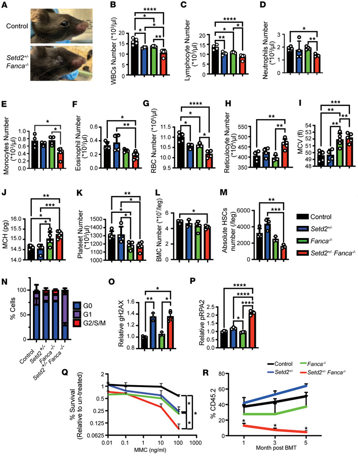 Characterization of BMF in a mouse model for FA.
(A) Representative phot...