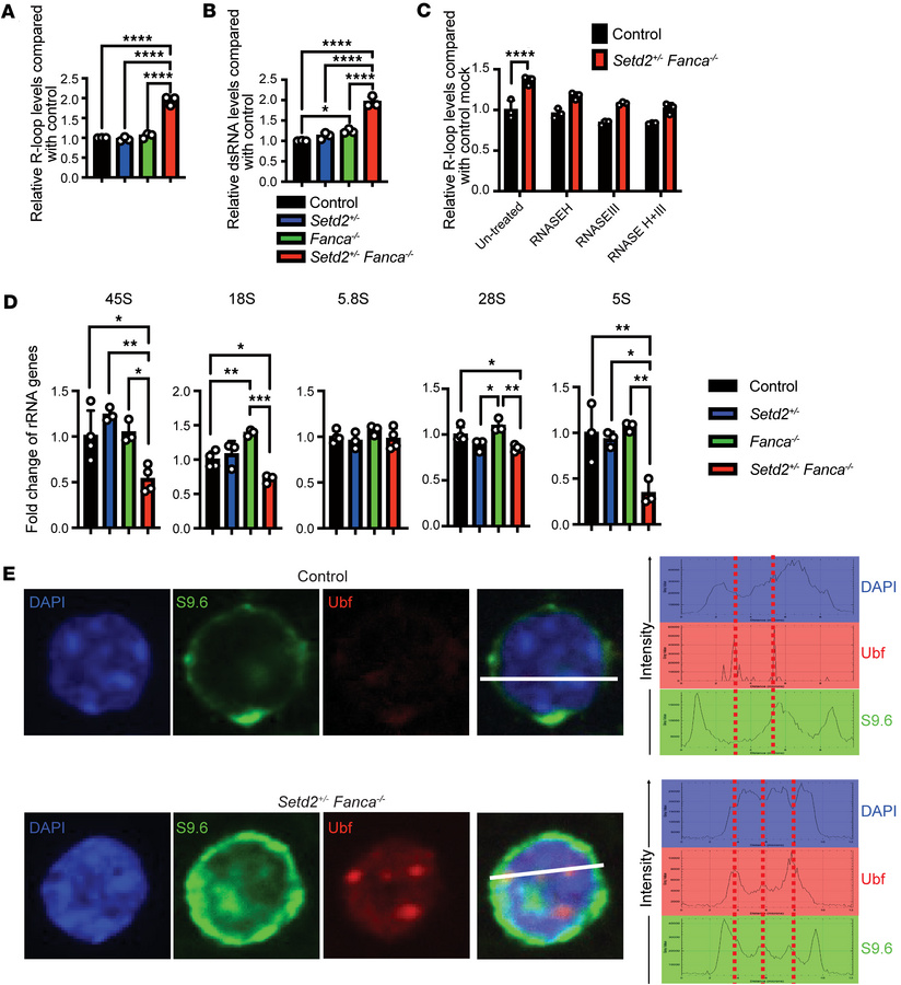 R-loop accumulation and ribosomal biogenesis defect in Setd2+/– Fanca–/–...