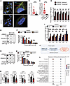 Human FANCA-deficient cells from a patient with FA display accumulation of