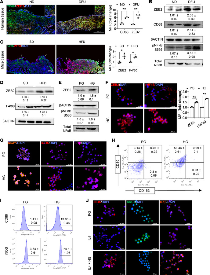 Elevated glucose levels induce the expression of ZEB2 and activate proin...