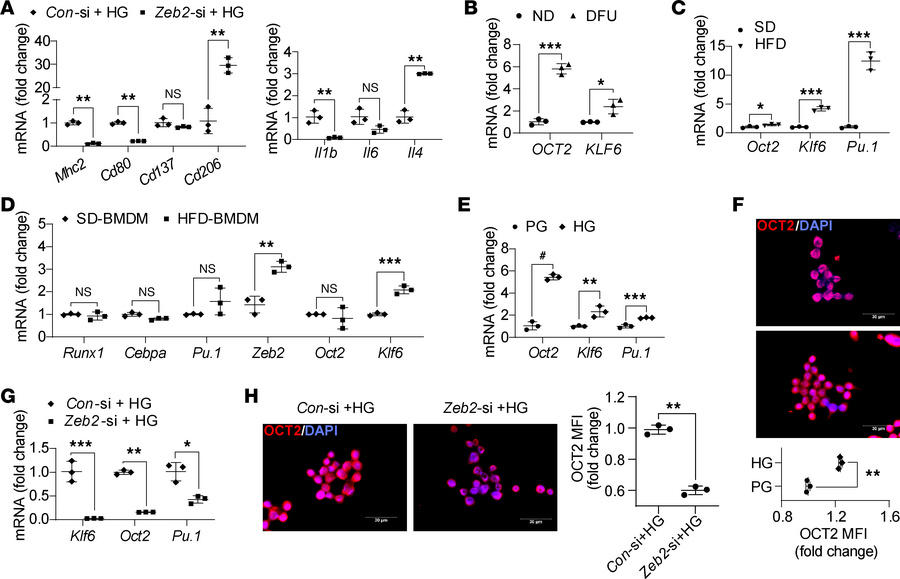 
Zeb2 silencing diminishes polarity of murine macrophages.
Downregulatio...