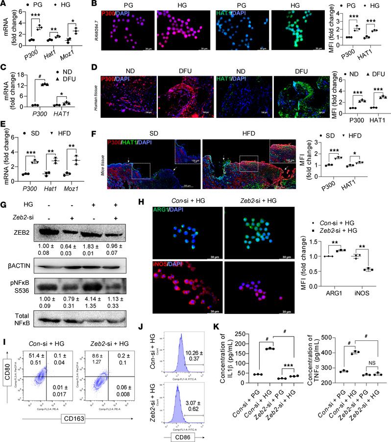 Inhibiting Zeb2 safeguards against hyperglycemia-induced macrophage infl...