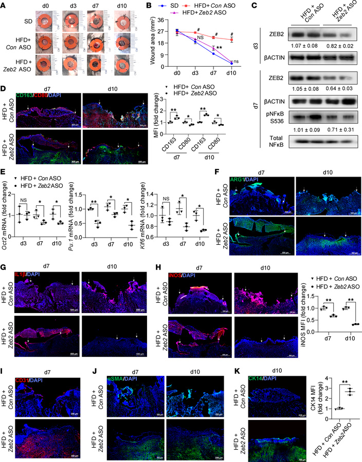 The suppression of Zeb2 ameliorated wound-healing complications in STZ-i...