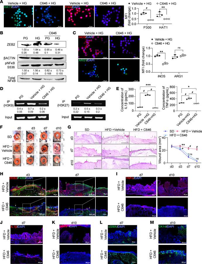 Inhibition of acetyltransferase activity ameliorated proinflammatory bur...