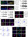 Elevated glucose levels induce the expression of ZEB2 and activate proinfla