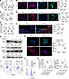 Inhibiting Zeb2 safeguards against hyperglycemia-induced macrophage inflamm