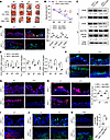 The suppression of Zeb2 ameliorated wound-healing complications in STZ-indu