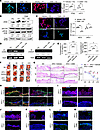 Inhibition of acetyltransferase activity ameliorated proinflammatory burden