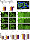 Cerebellum and Purkinje cell morphology are altered in SCA14 mice.