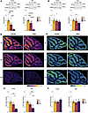 PKCγ and PKCα are gene dose–dependently reduced in SCA14 mice.