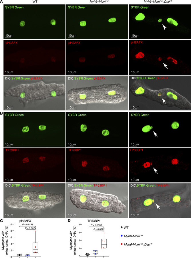 Detection of cytosolic nDNA stained with phosphorylated H2AFX or TP53BP1...