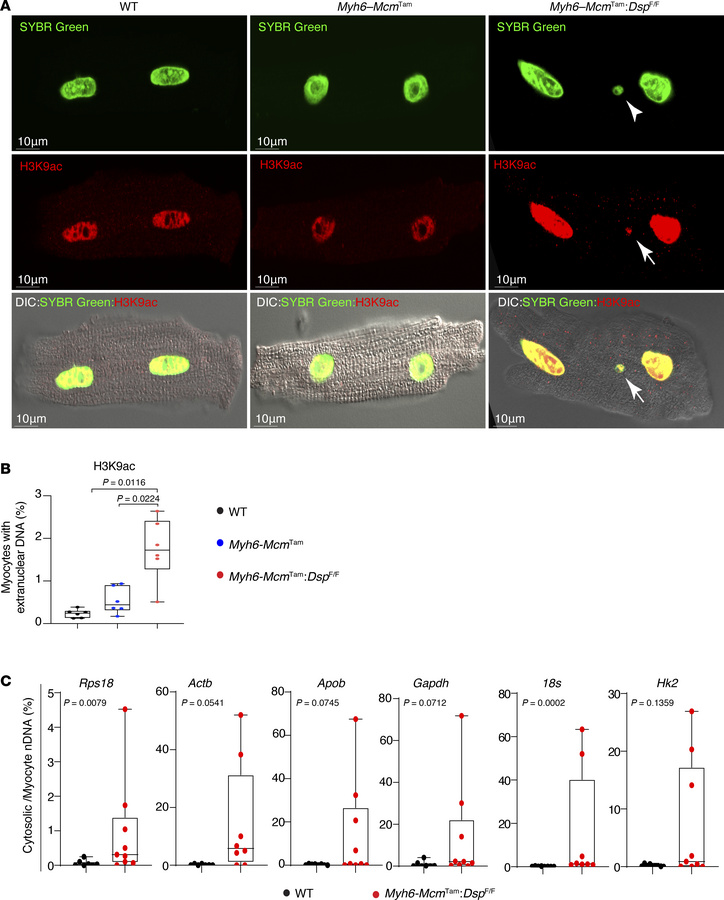 Detection of cytosolic nDNA stained with H3K9ac in cardiomyocytes.
(A) M...