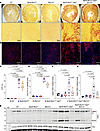Effects of deletion of Mb21d1 gene on myocardial fibrosis.