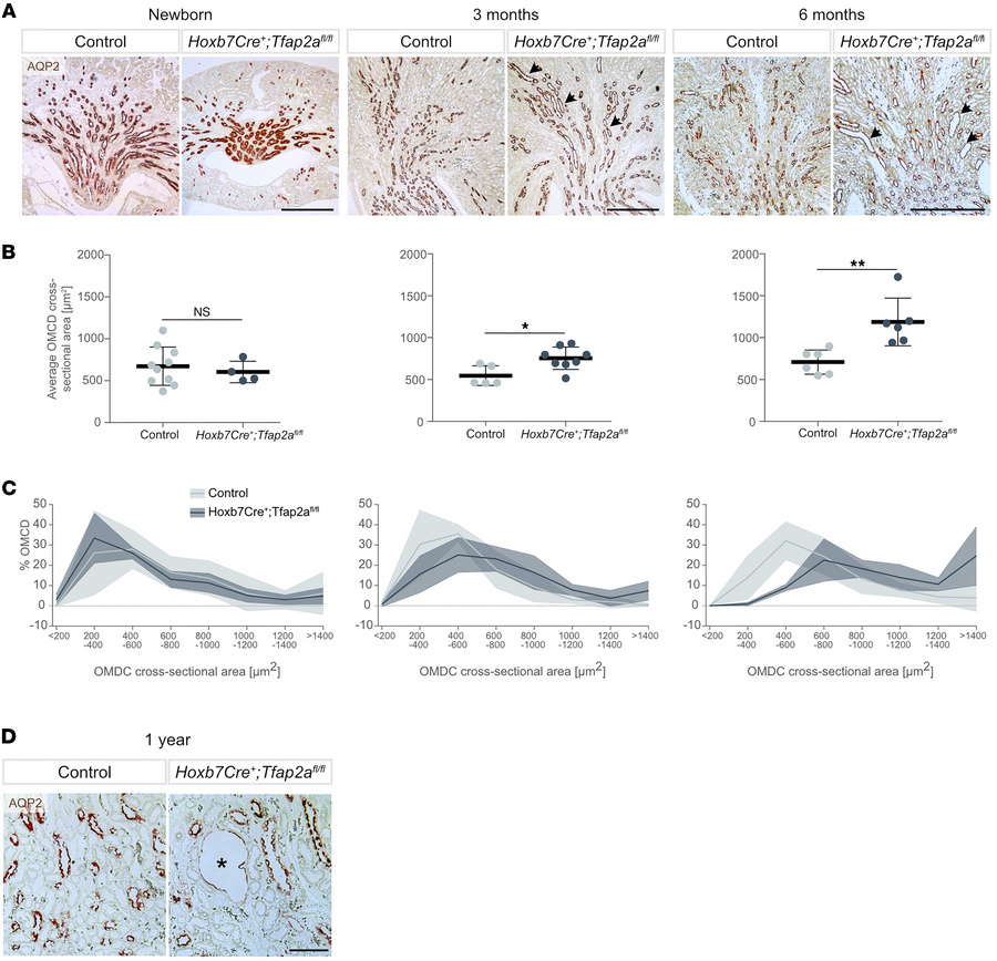
Hoxb7Cre+;Tfap2afl/fl mice present dilated outer medullary collecting d...