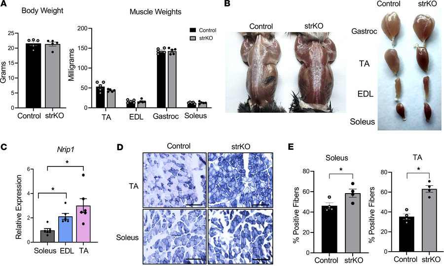 Striated muscle–specific RIP140-KO (strNrip1–/–) mice display an oxidati...