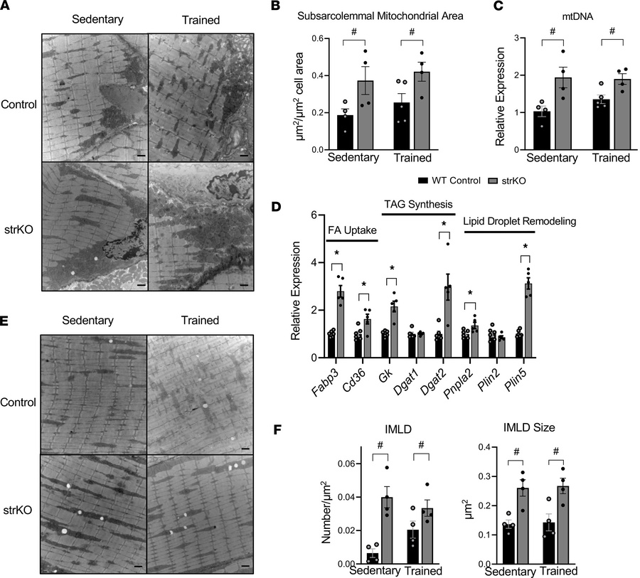 The ultrastructure of strNrip1–/– EDL reveals increased subsarcolemmal m...