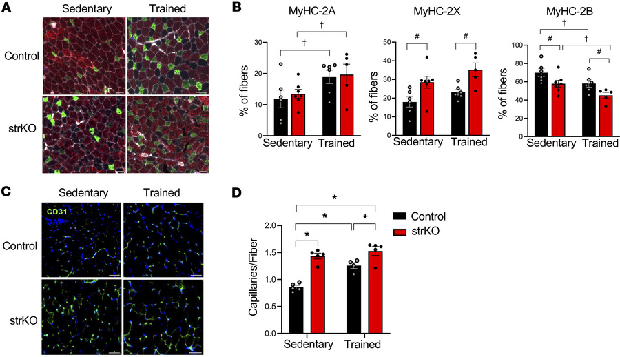 strNrip1–/– mice display a shift in fiber type and increased angiogenesi...