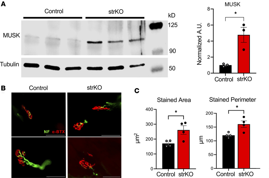 Neuromuscular junction (NMJ) remodeling in sedentary strNrip1–/– mouse m...
