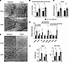 The ultrastructure of strNrip1–/– EDL reveals increased subsarcolemmal mito