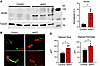 Neuromuscular junction (NMJ) remodeling in sedentary strNrip1–/– mouse musc