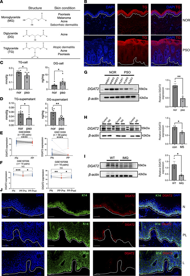 Dysregulated glyceride metabolism and decreased DGAT2 expression in lesi...