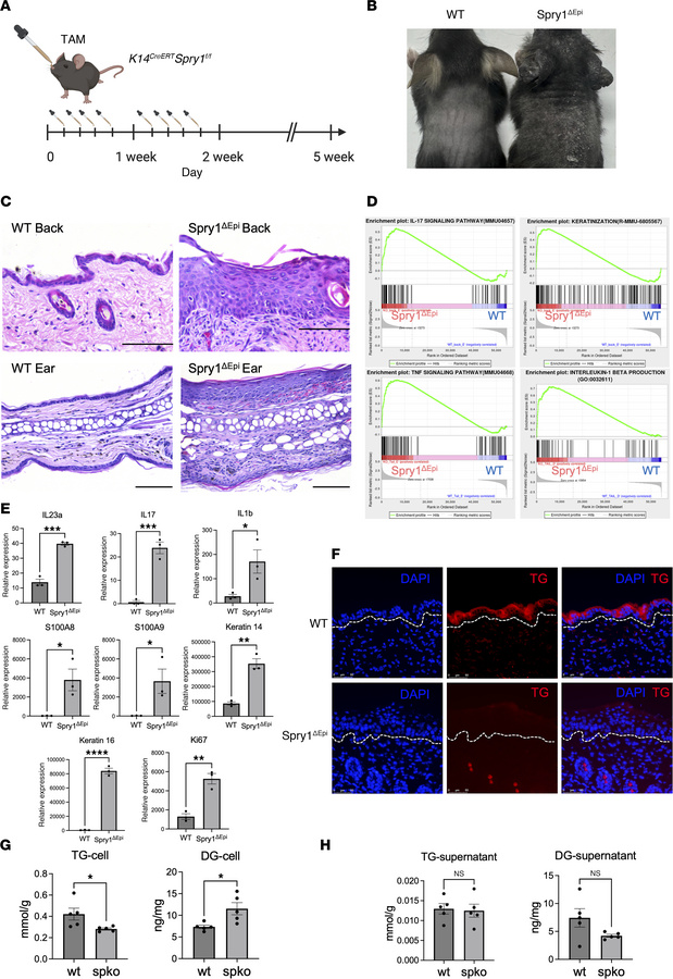 Spry1ΔEpi mice exhibit psoriasis-like symptoms and dysregulated glycerid...