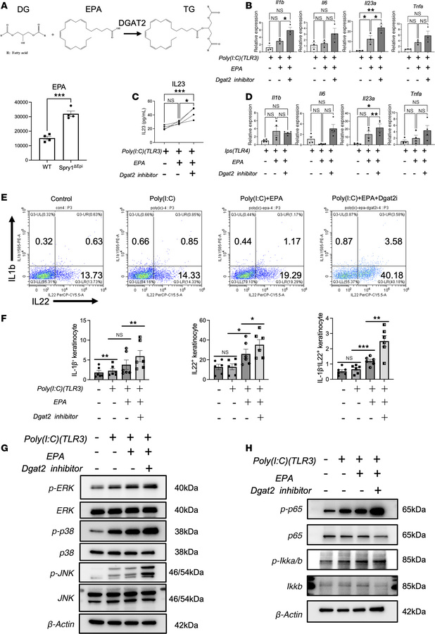 DGAT2 inhibition and EPA amplify TLR3-mediated inflammatory responses in...