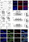 Dysregulated glyceride metabolism and decreased DGAT2 expression in lesiona
