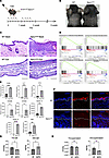 Spry1ΔEpi mice exhibit psoriasis-like symptoms and dysregulated glyceride m