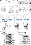 DGAT2 inhibition and EPA amplify TLR3-mediated inflammatory responses in ke