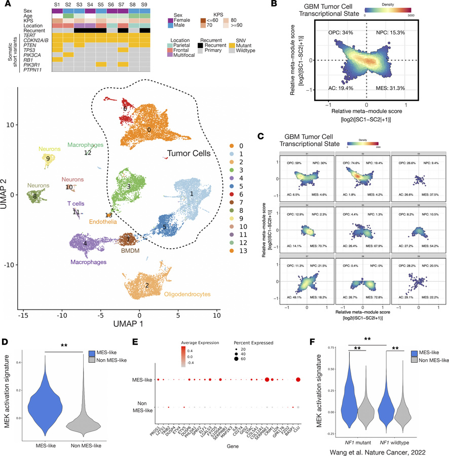 SnRNA-Seq of human NF1-mutant, IDH wild-type glioblastoma (n = 9) reveal...