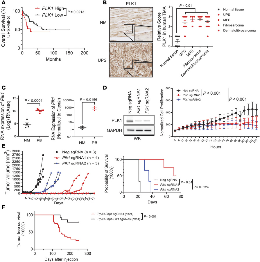 
Plk1 knockdown inhibits growth of Bap1-deficient sarcomas.
(A) High PLK...