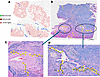 Migration trails identified in a human lung cancer sample and their project