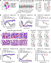 Blockade of oxidative PPP at the 6PGD metabolic checkpoint ameliorates the