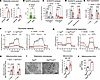 6PGD blockade in T cells induces a metabolic reprogramming evident by reduc