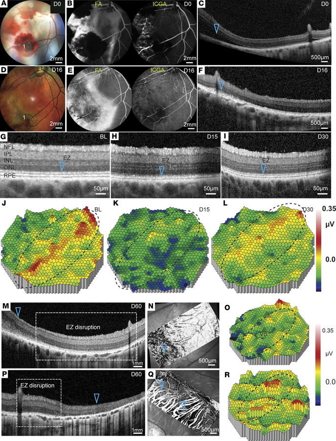 CR injury recovery in the long-term evaluation.
(A–F) Color fundus (A an...