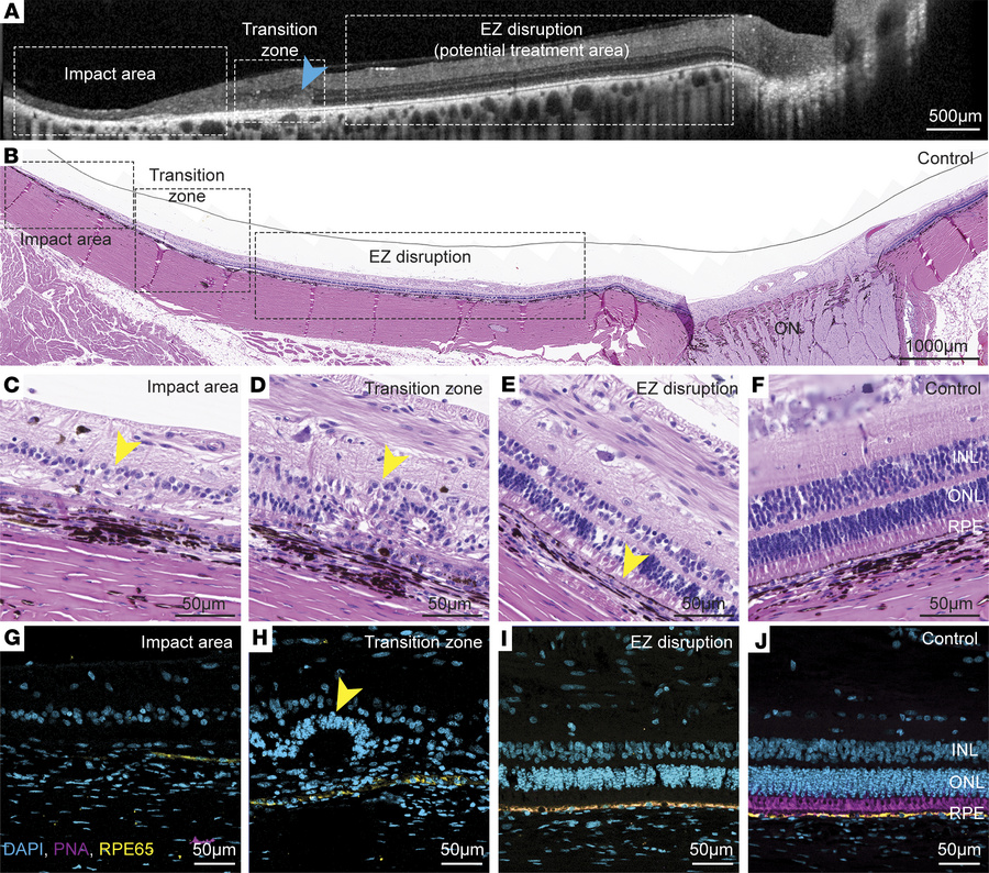 Histological analysis of CR model porcine eyes.
(A and B) Terminal point...
