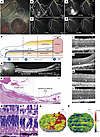 Short-term evaluation of pig eyes with CR injury.