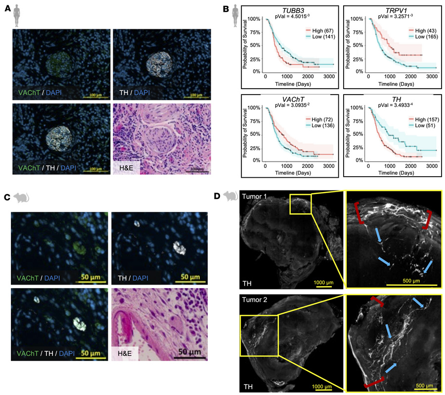 Human and murine PDAC tumors are innervated by autonomic nerves.
(A) Co-...